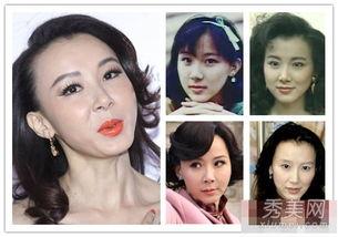 有没有明星没整容,谁曾坚守自然之美？